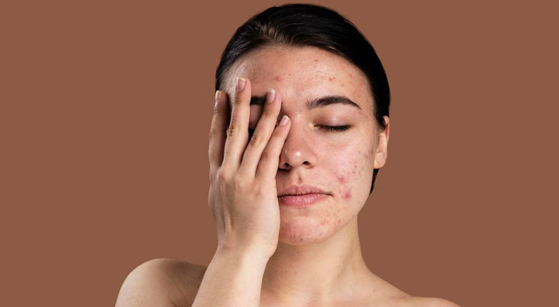 شوینده های مناسب پوست حساس