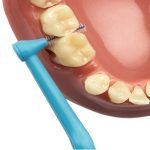 مسواک بین دندانی تپه مدل Angle سایز 3 بسته 6 عددی